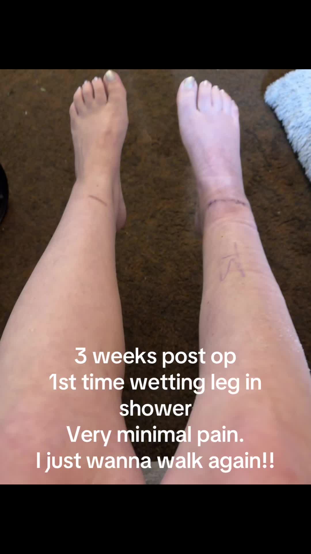 @K