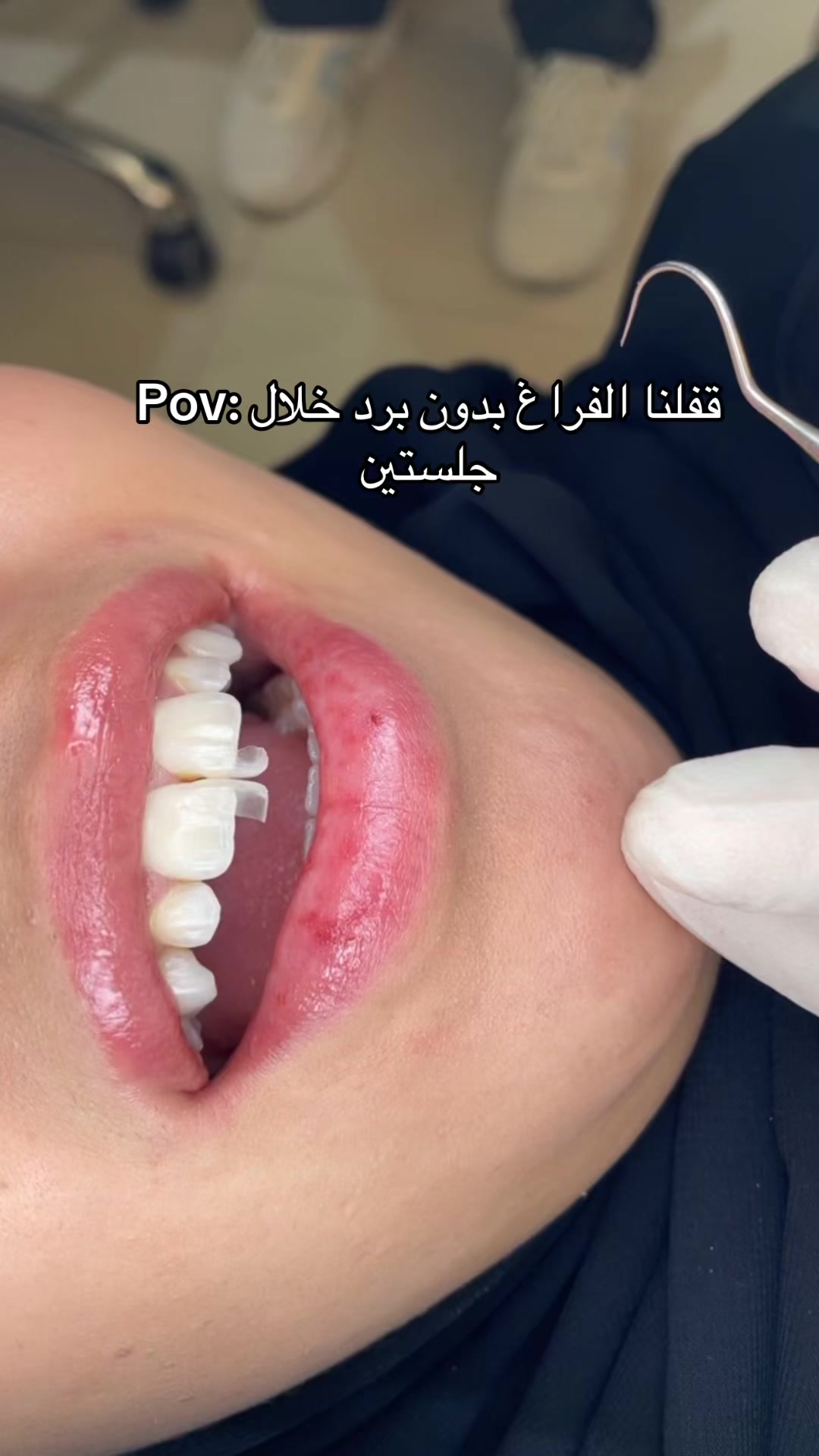 @Dr. Abrar Alhababi