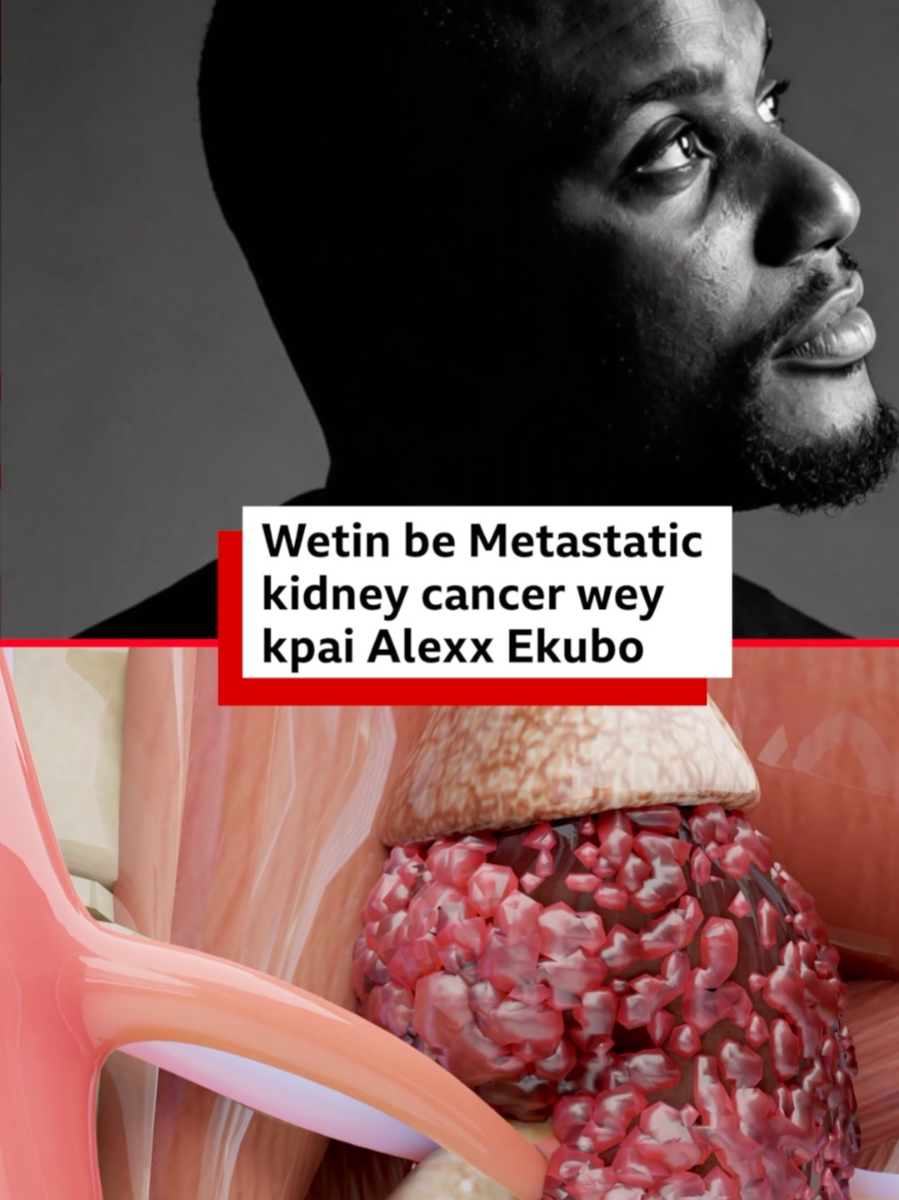 @BBC News Pidgin
