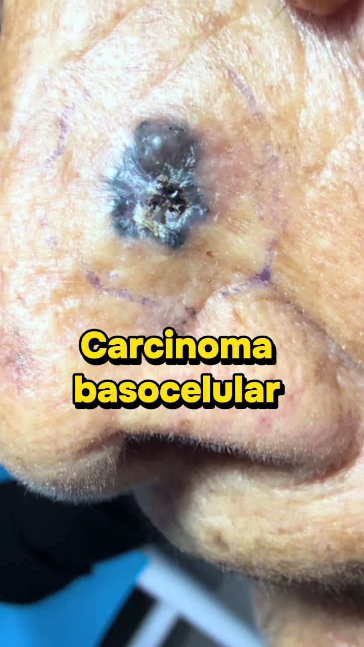 @dr.idrogodermatologo