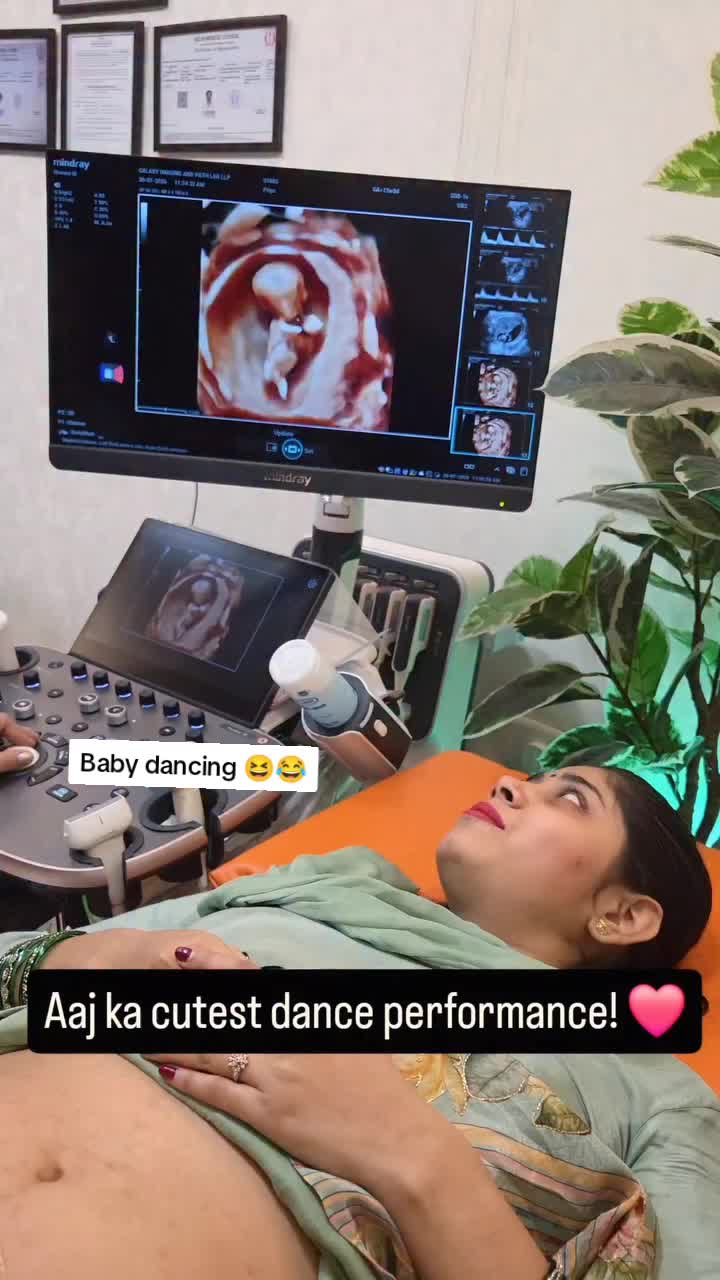 @Alina