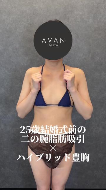 @森脇進/二の腕脂肪吸引・豊胸/AVAN TOKYO