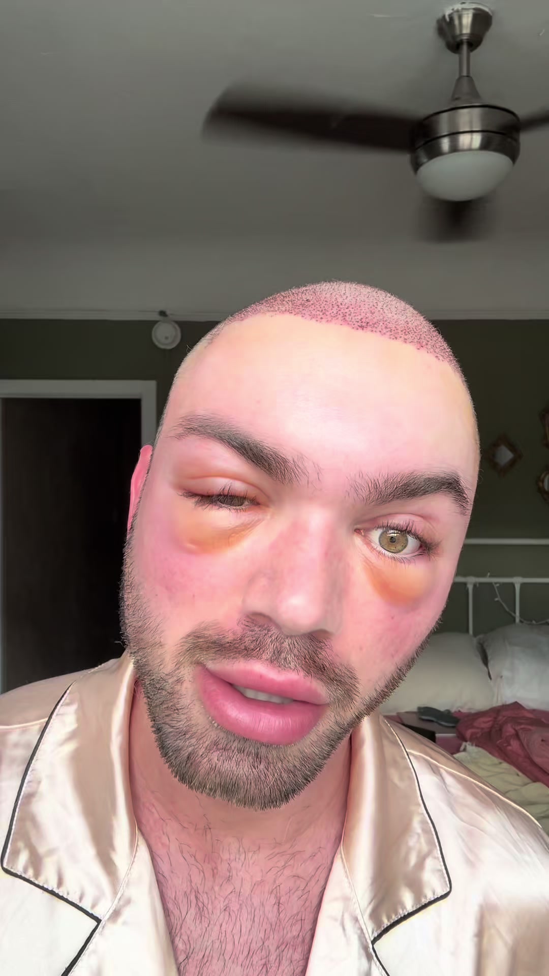 @richlen
