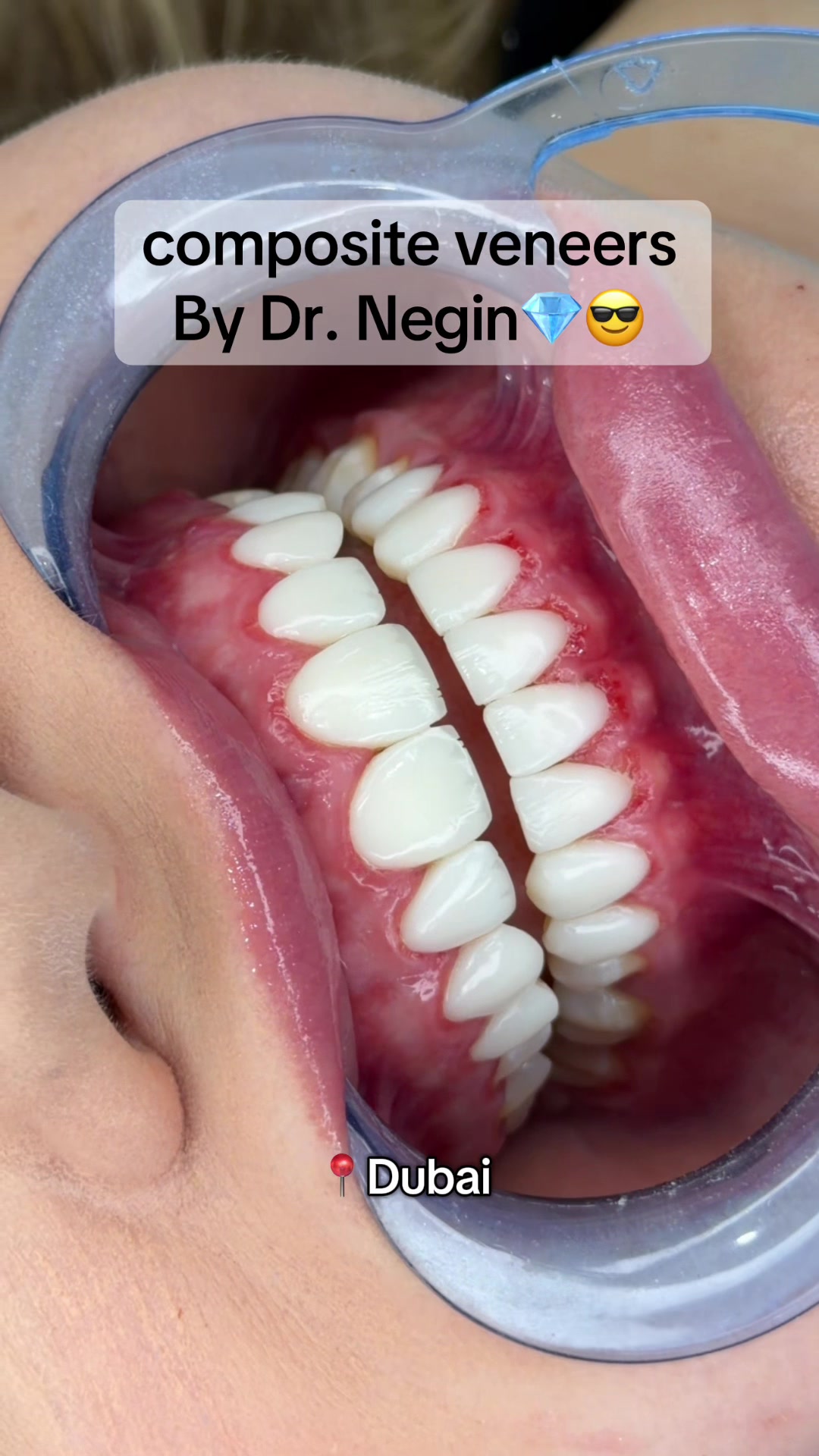 @dr.negin1
