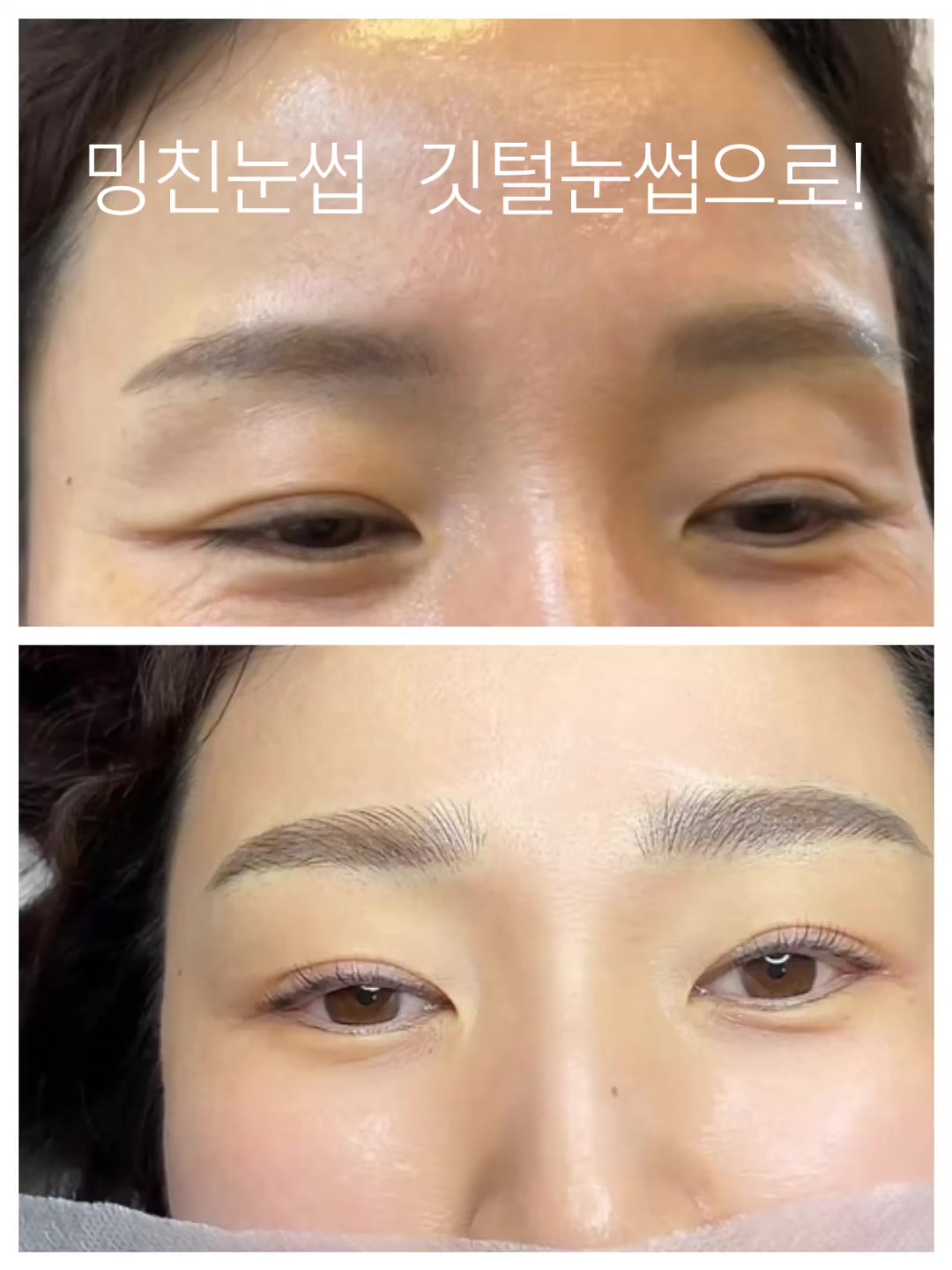 @운정피부관리 서연뷰티