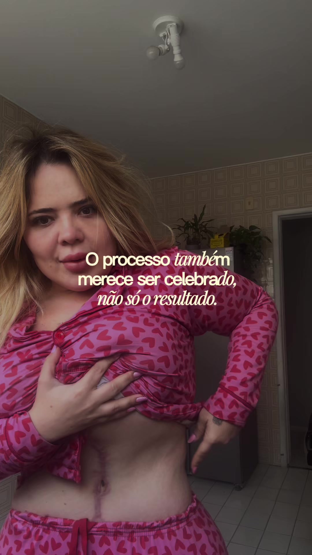 @Bruna Medeiros