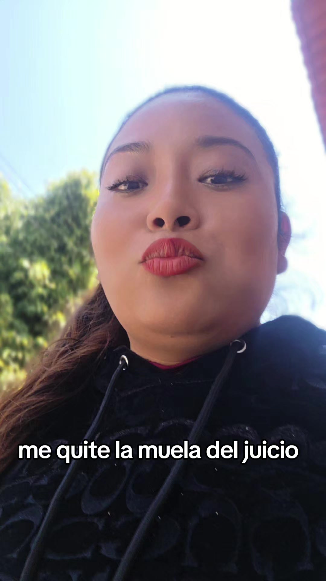 @Leidy Bartolon