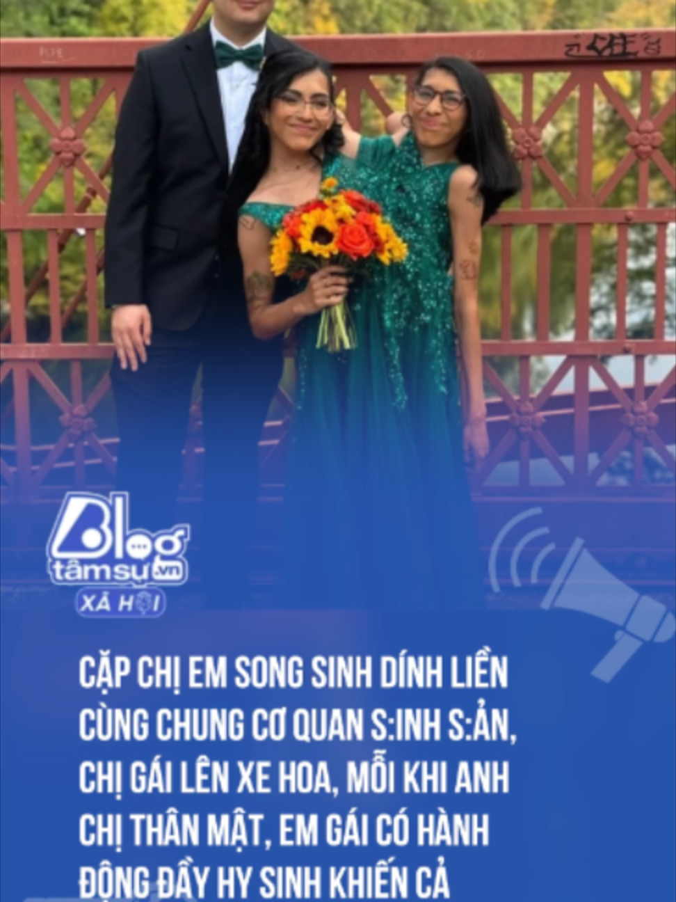 @Tin X&atilde; Hội - Blog T&acirc;m Sự