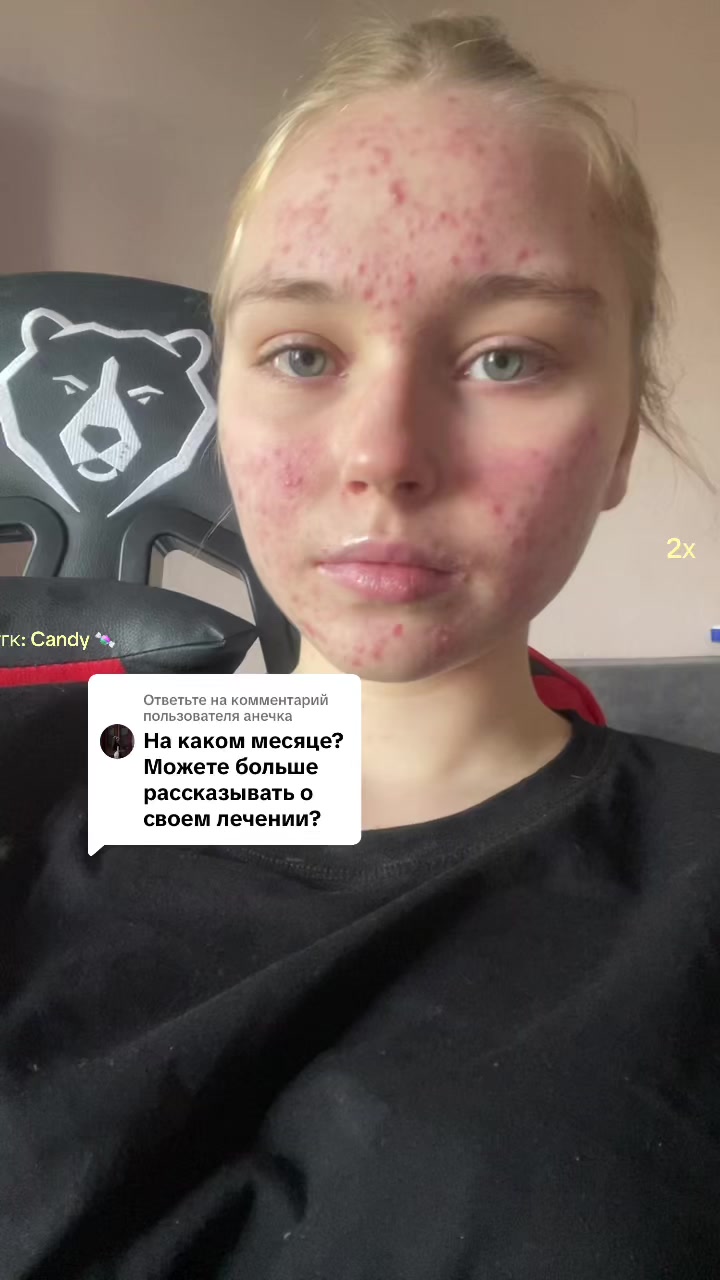 @sssshhl2