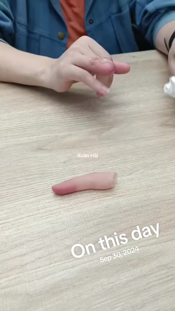 @Hải Râu Tay Chân Giả