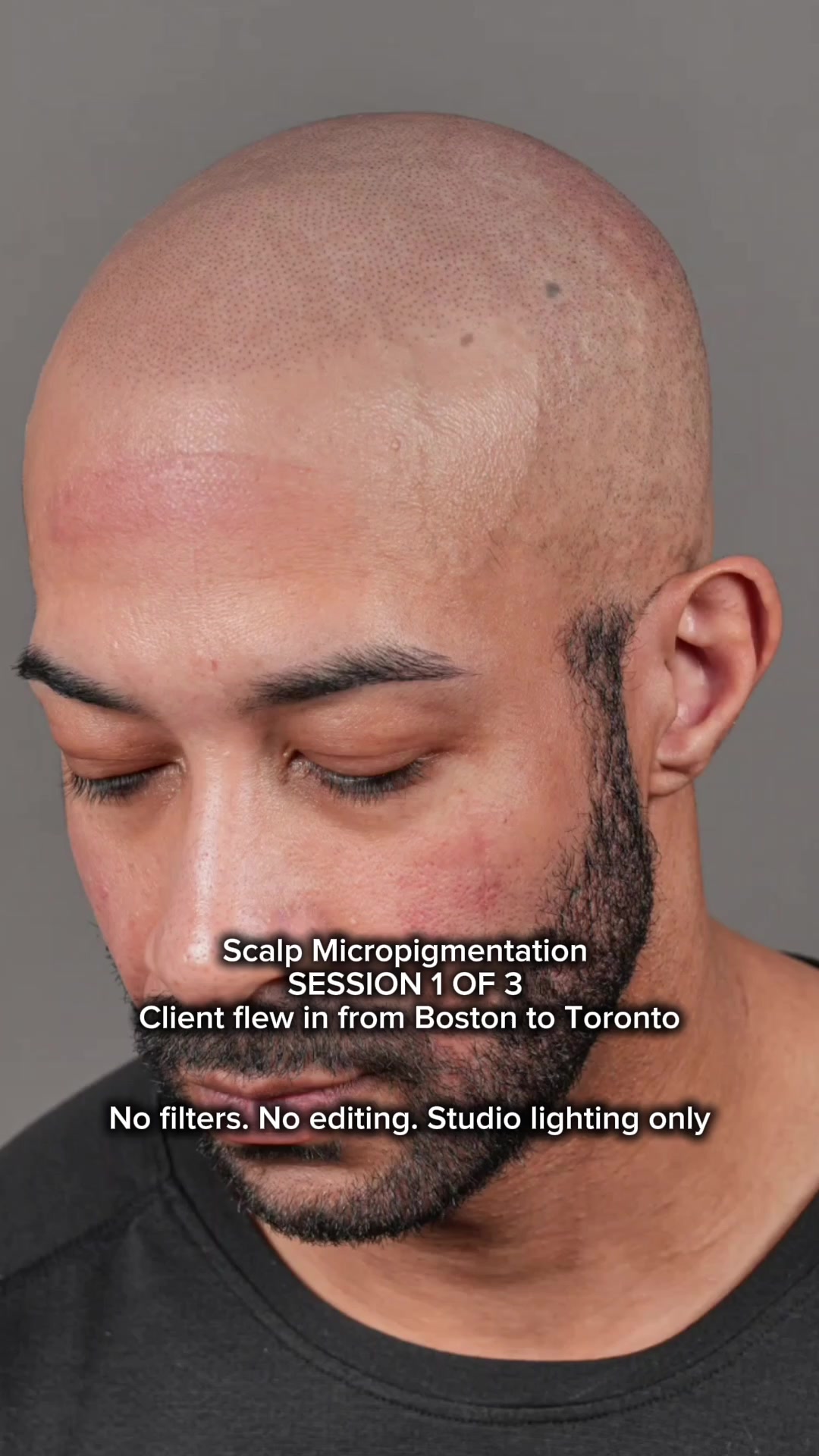 @Enhanced Scalp