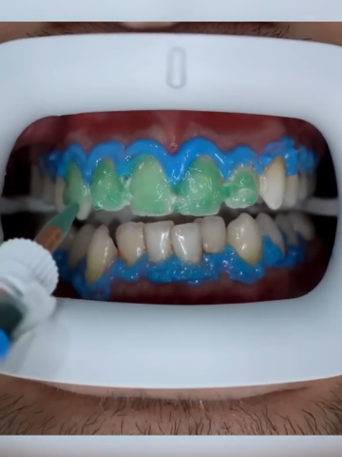 @Tech Dental