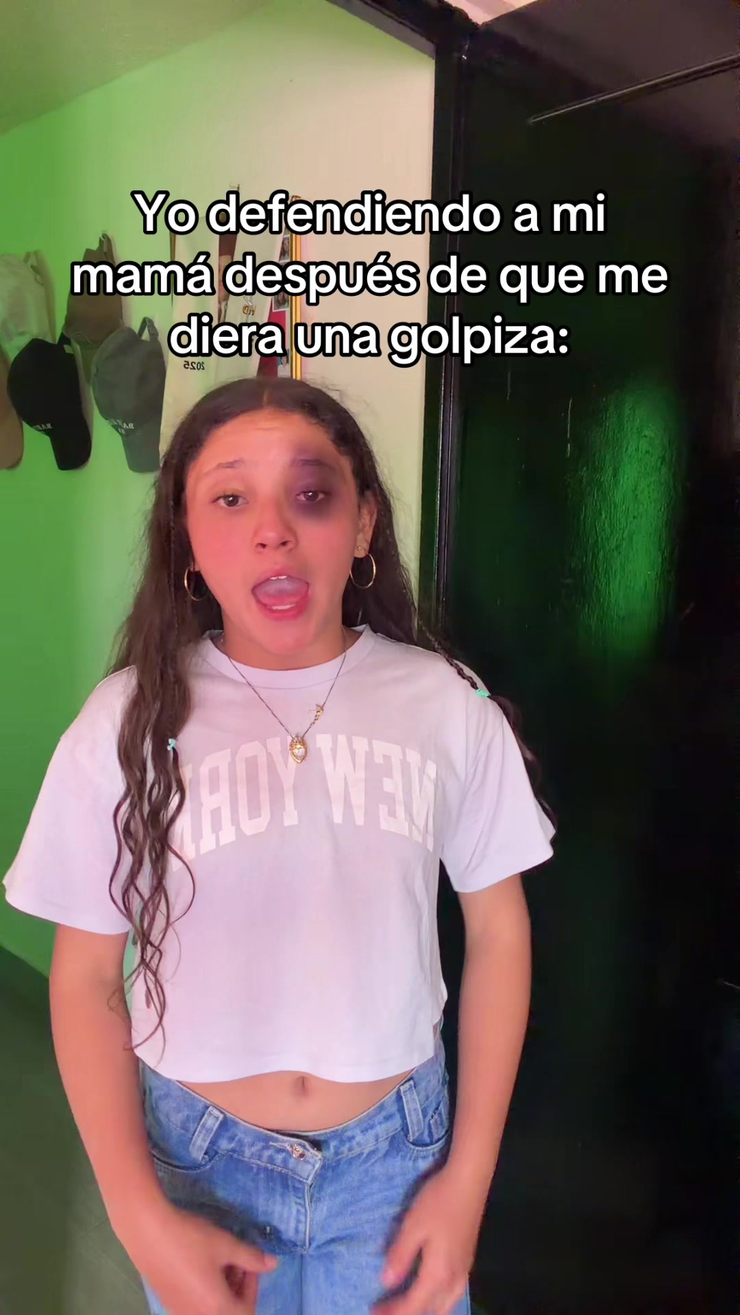 @Eimy Escudero