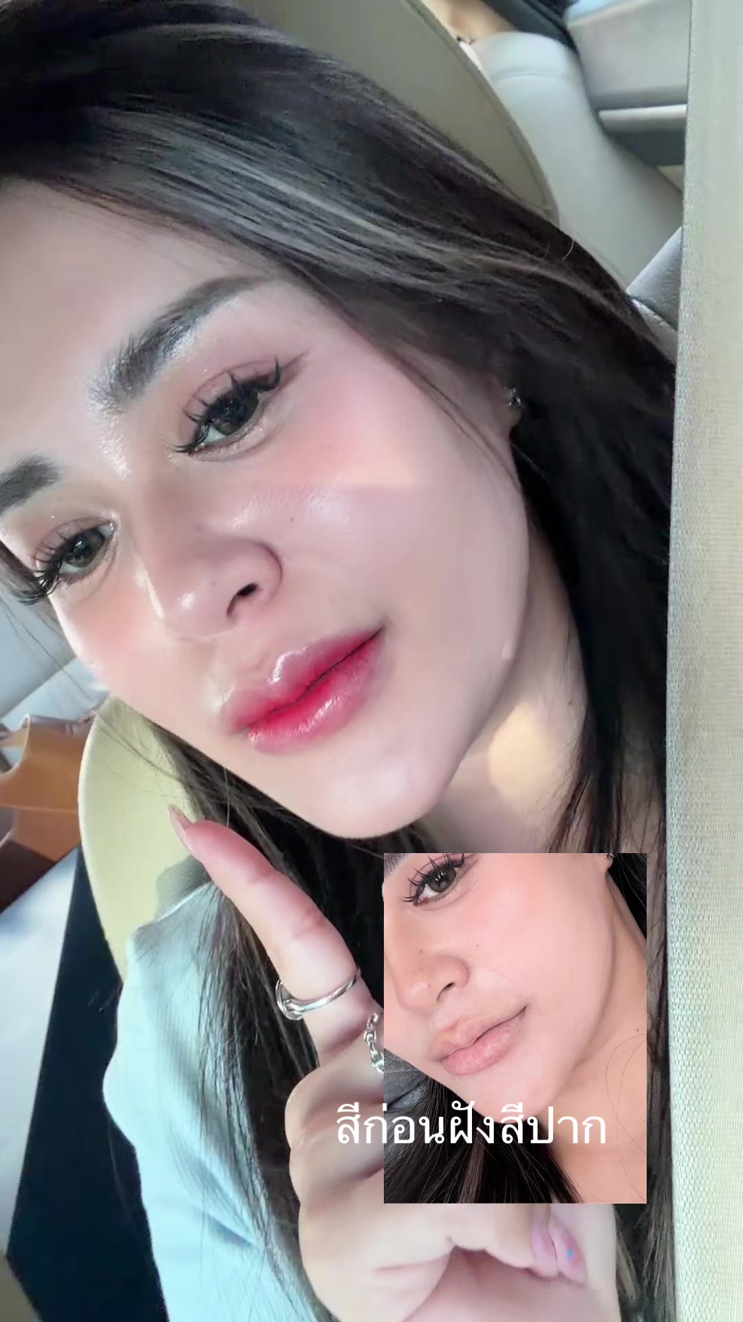@aommko