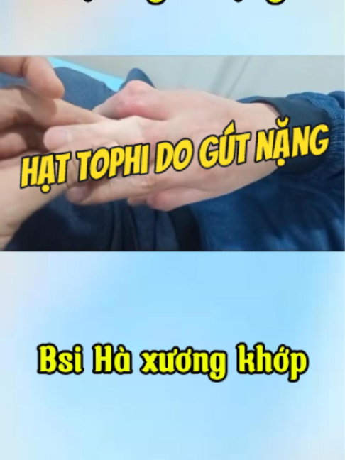 @Chuyên gia xương khớp