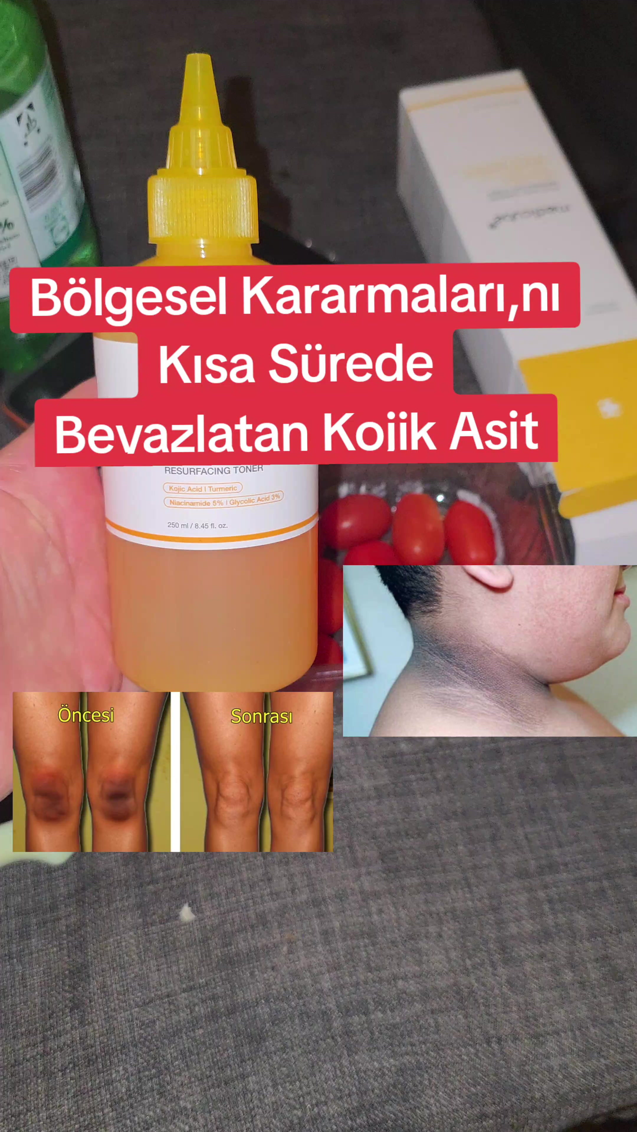 @Gurbet Ana