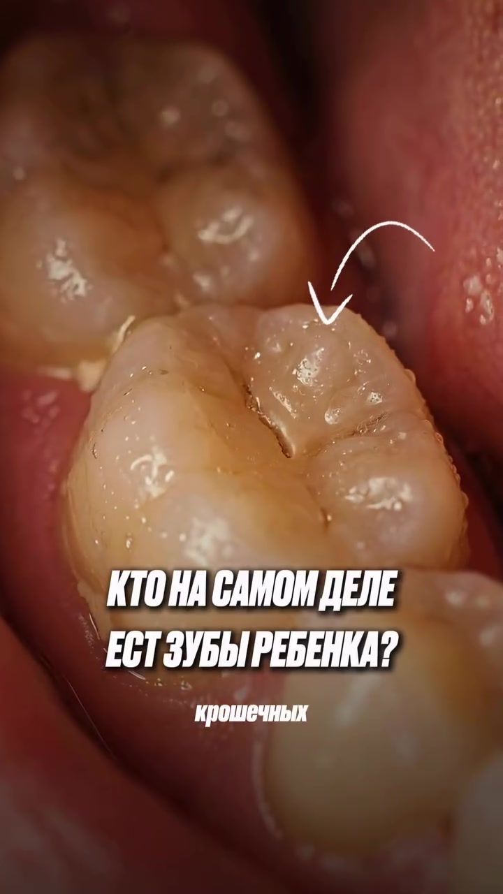 @Dent_tooth