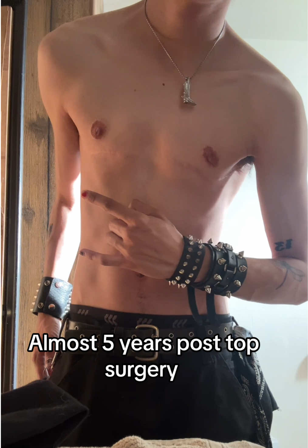 @Ty