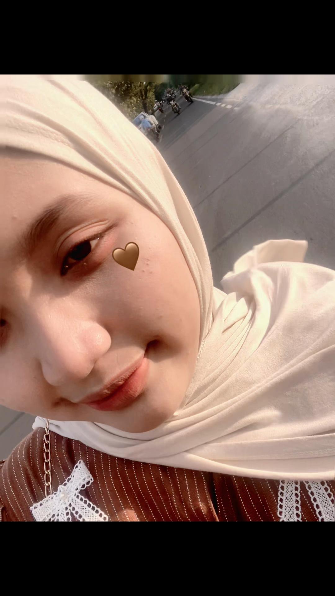@Auraaa__