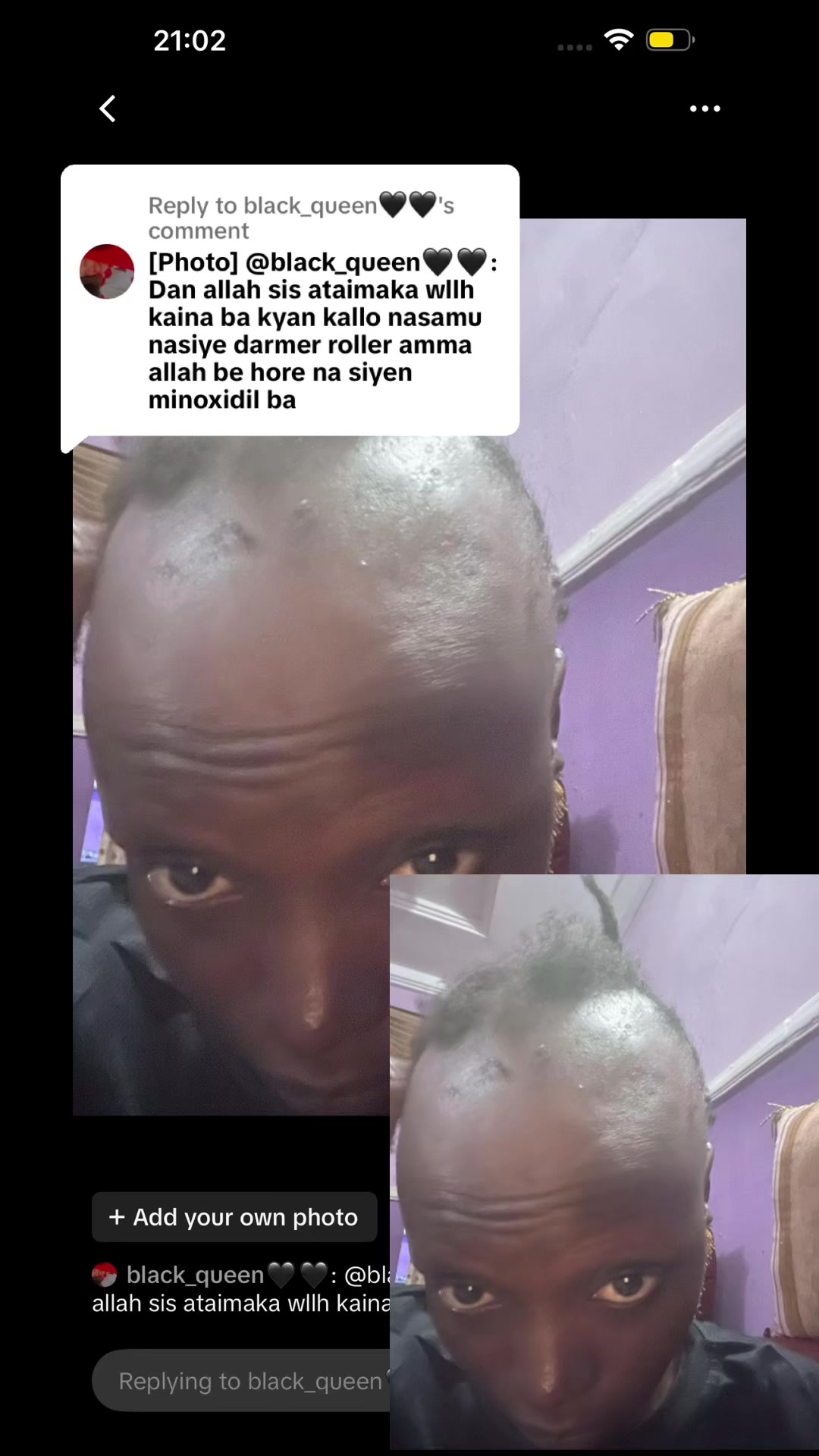 @Aunty solution hair & skin