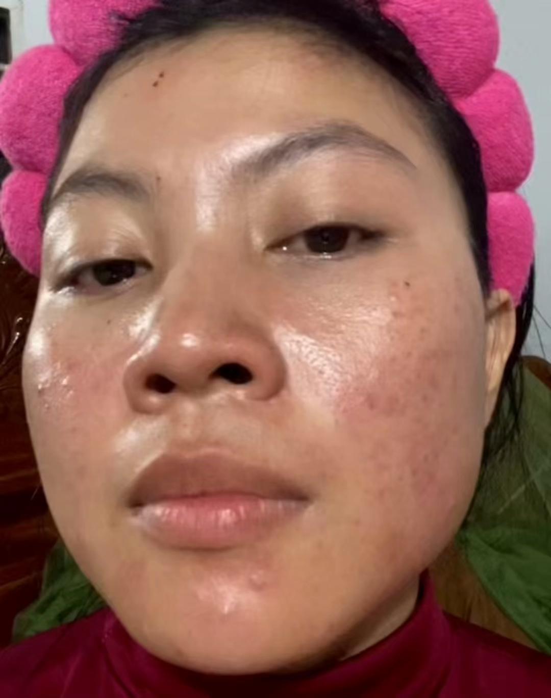 @OUN PICH๐๐
