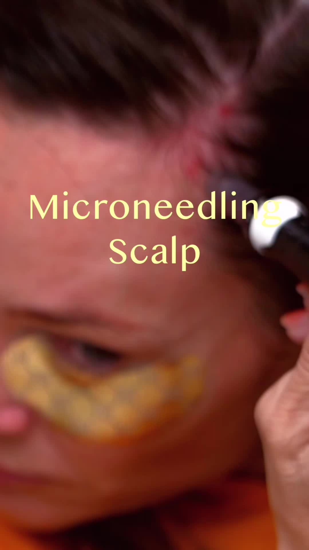 @DIY SKINCARE