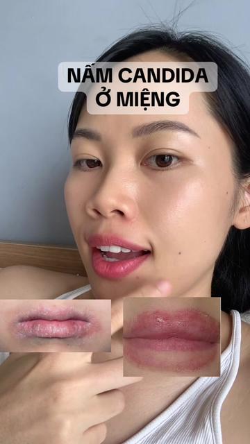 @huyendao_thaidoc