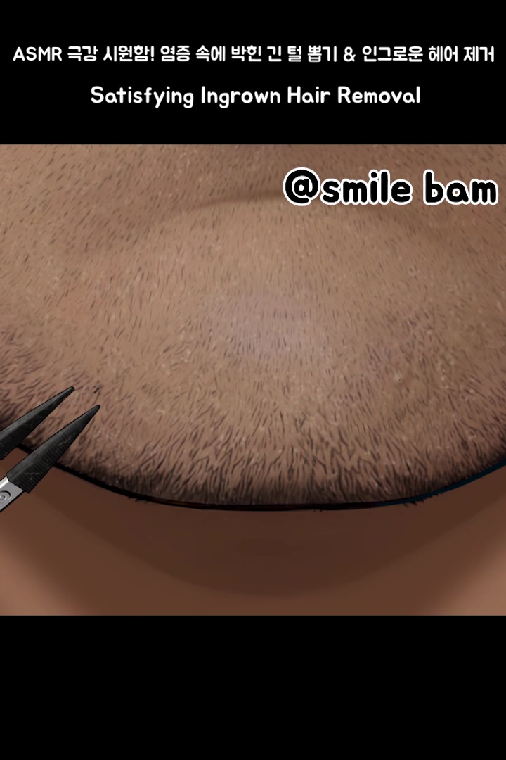 @Smile Bam