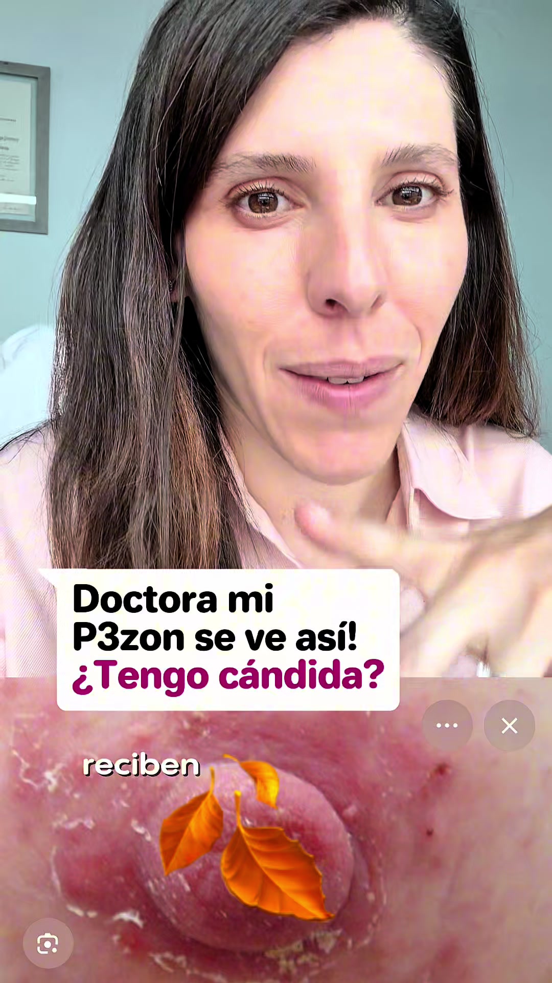 @Lizymarcekunilacta