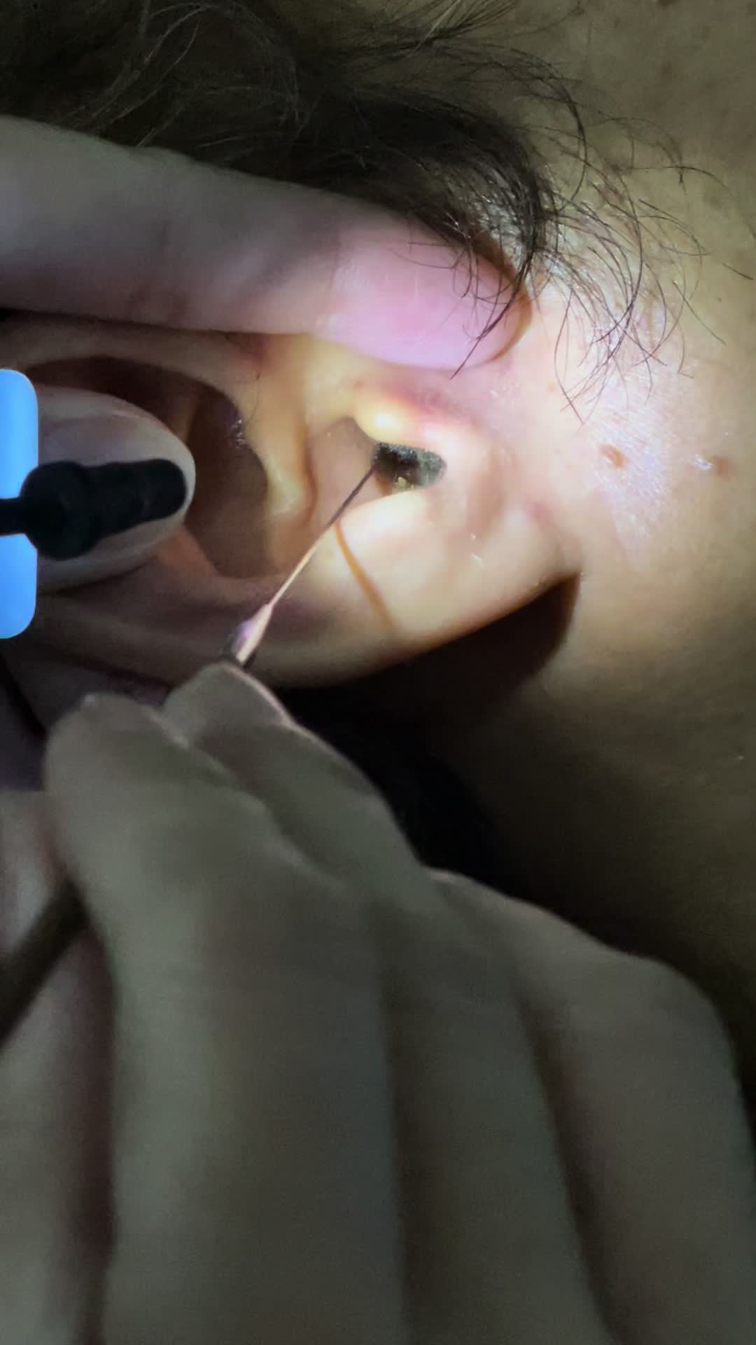 @ហាង សំអាតត្រចៀក 081 674455