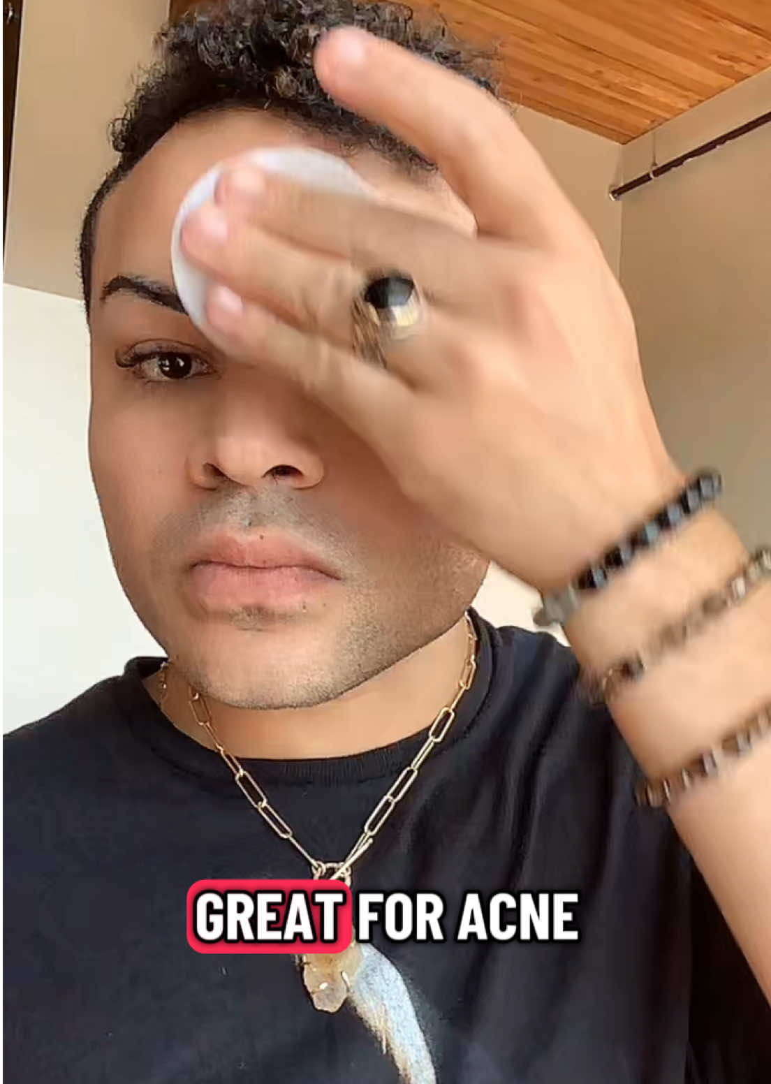 @juanwild3
