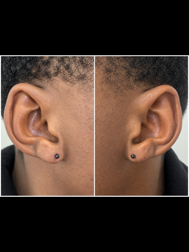 @Shroomies tattoos & piercings