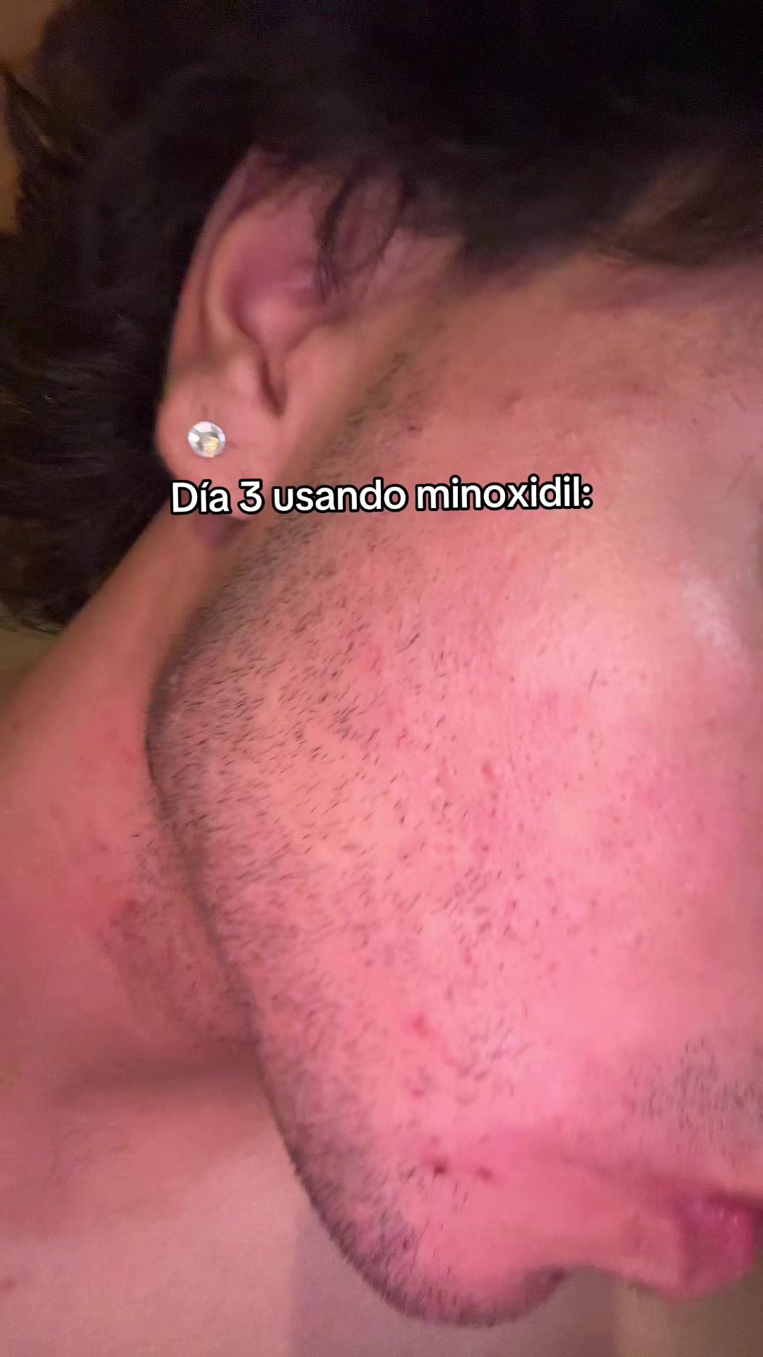 @Dani G