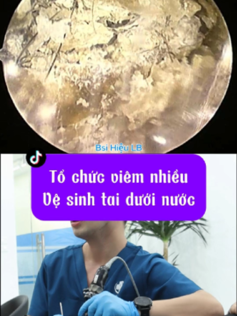 @Bs Hiệu Tai Mũi Họng Long Bi&ecirc;n