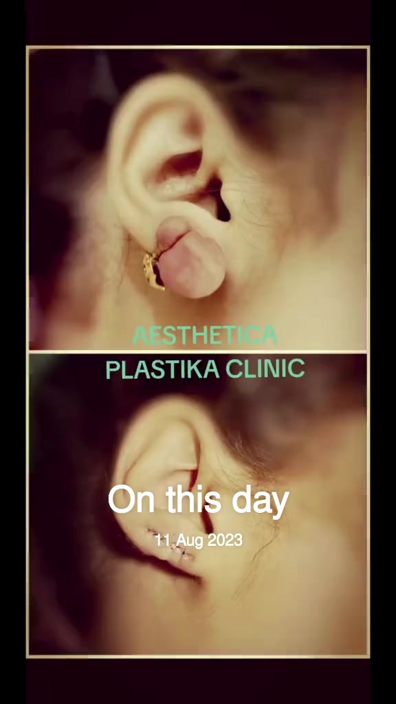 @Dr Firdous Khan PlasticSurgeon