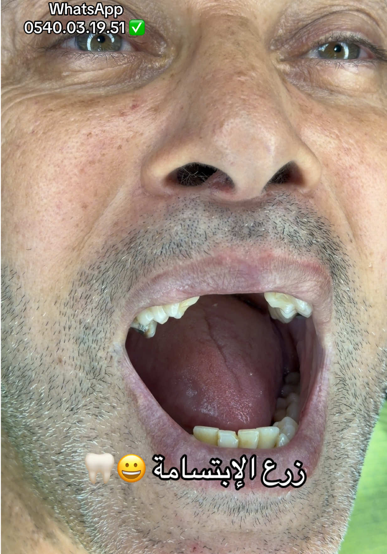 @Docteur Zitouni