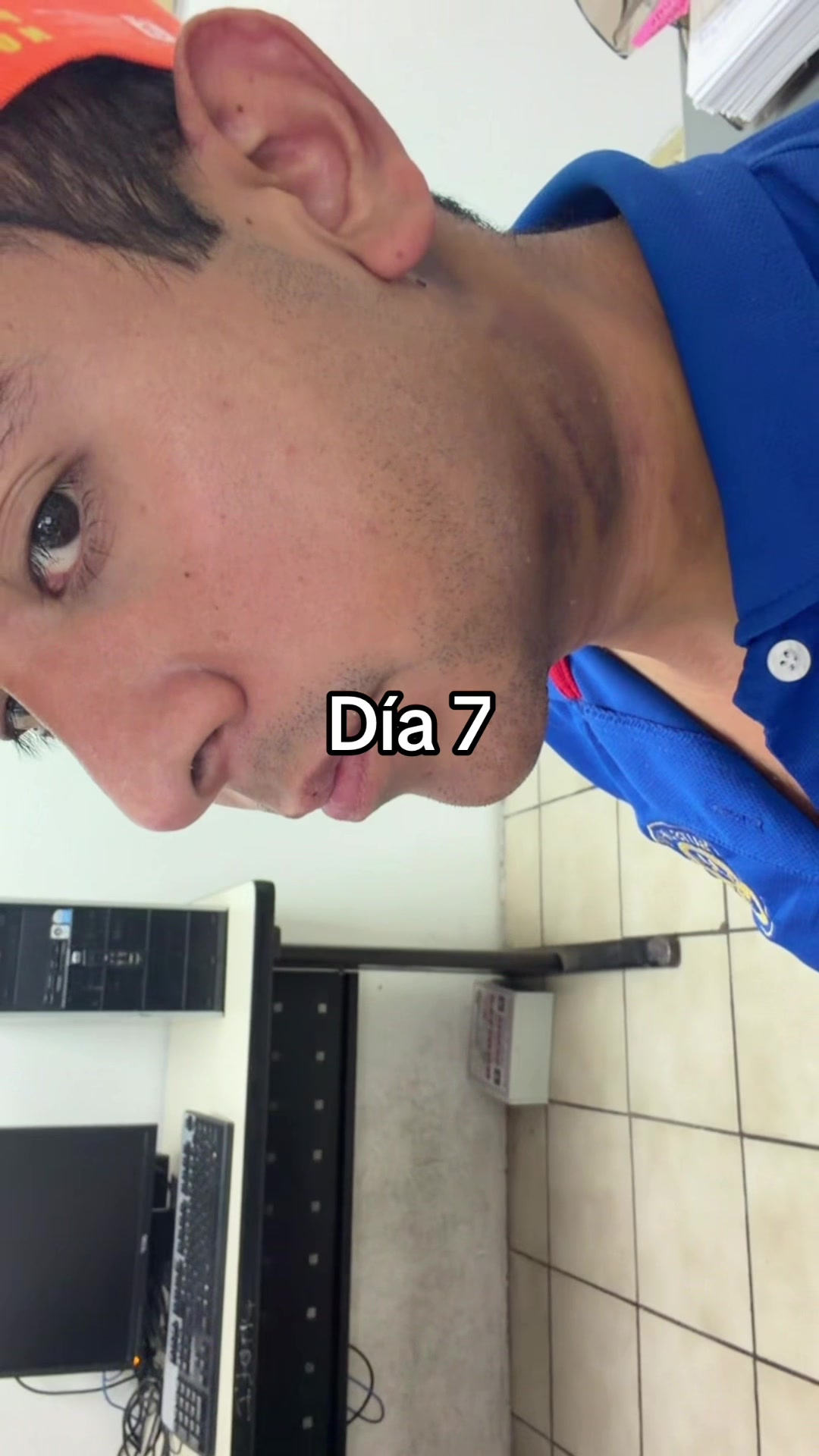 @Alvaro Reyes