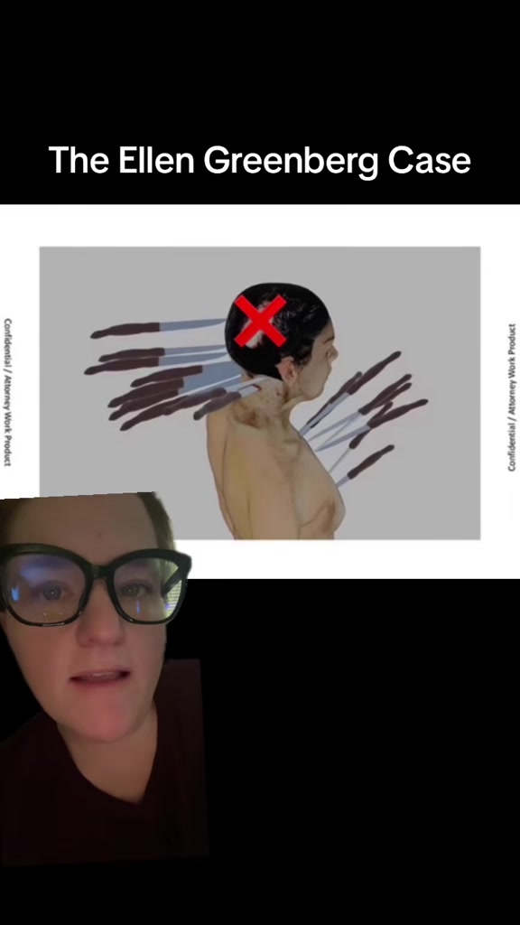 @NoShadyDays