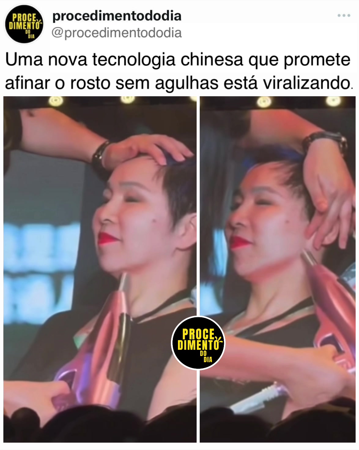 @procedimentododia