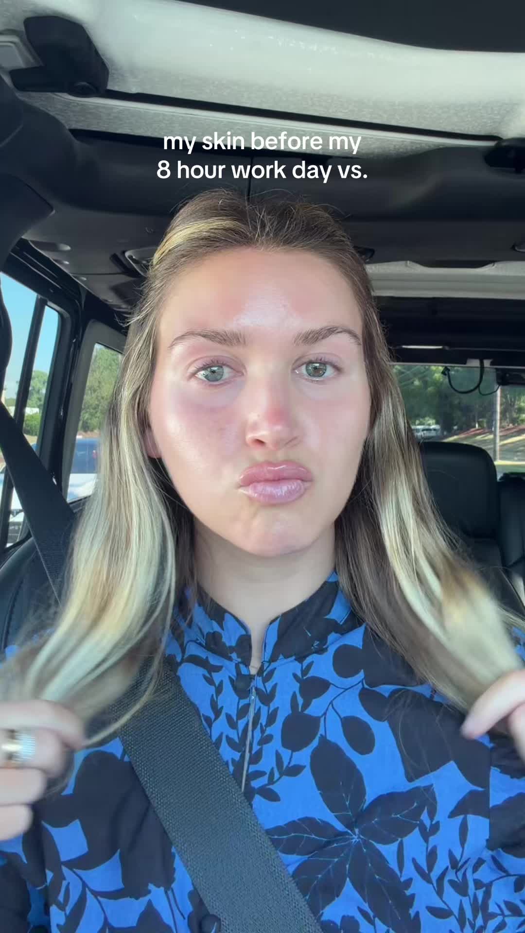 @Millie