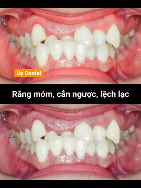 @Nha khoa niềng răng Up Dental