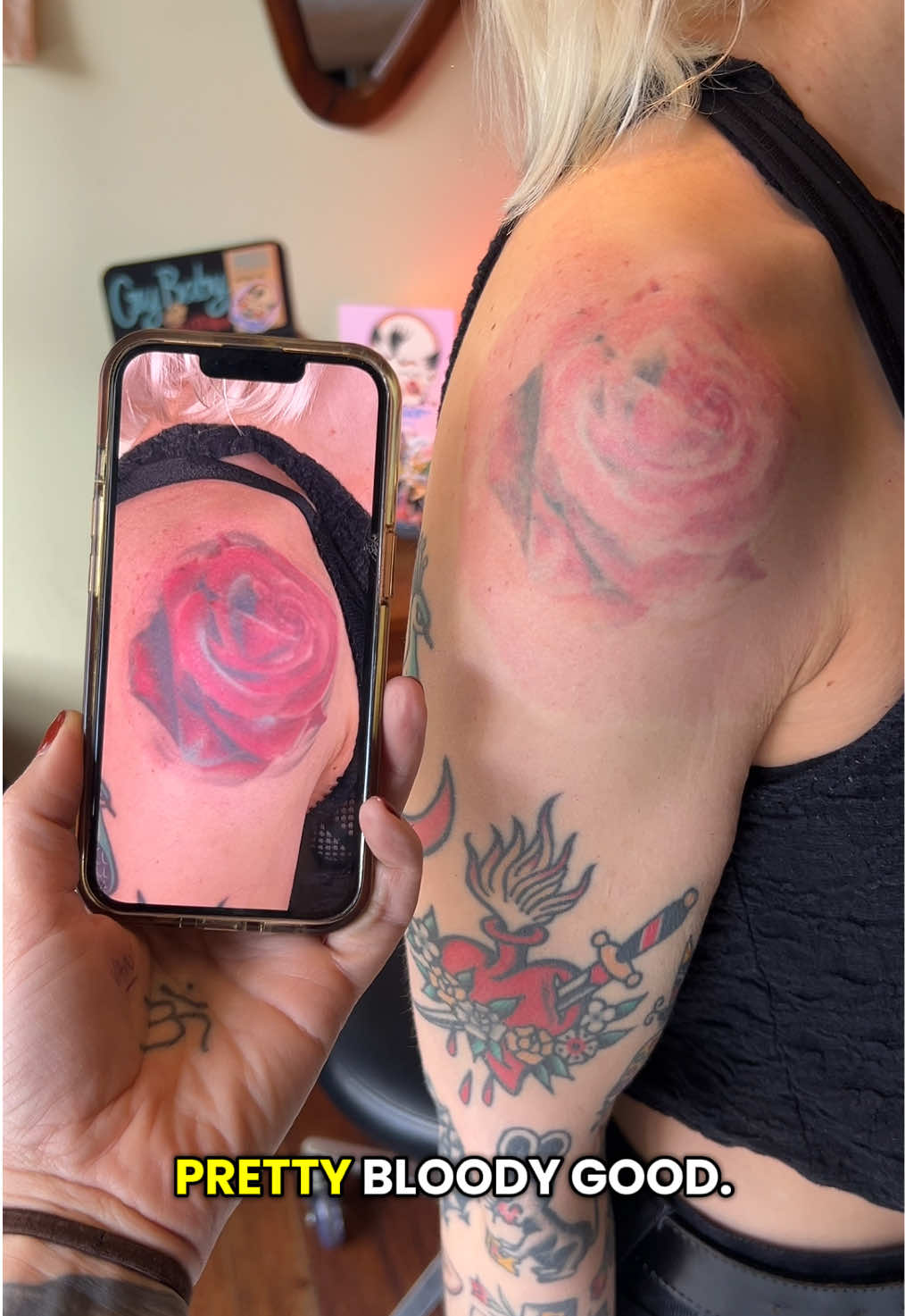 @Swift_tattoo_removal