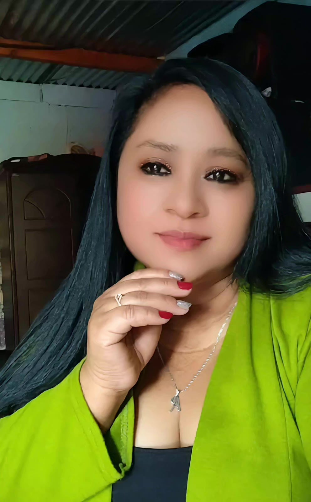 @Anita