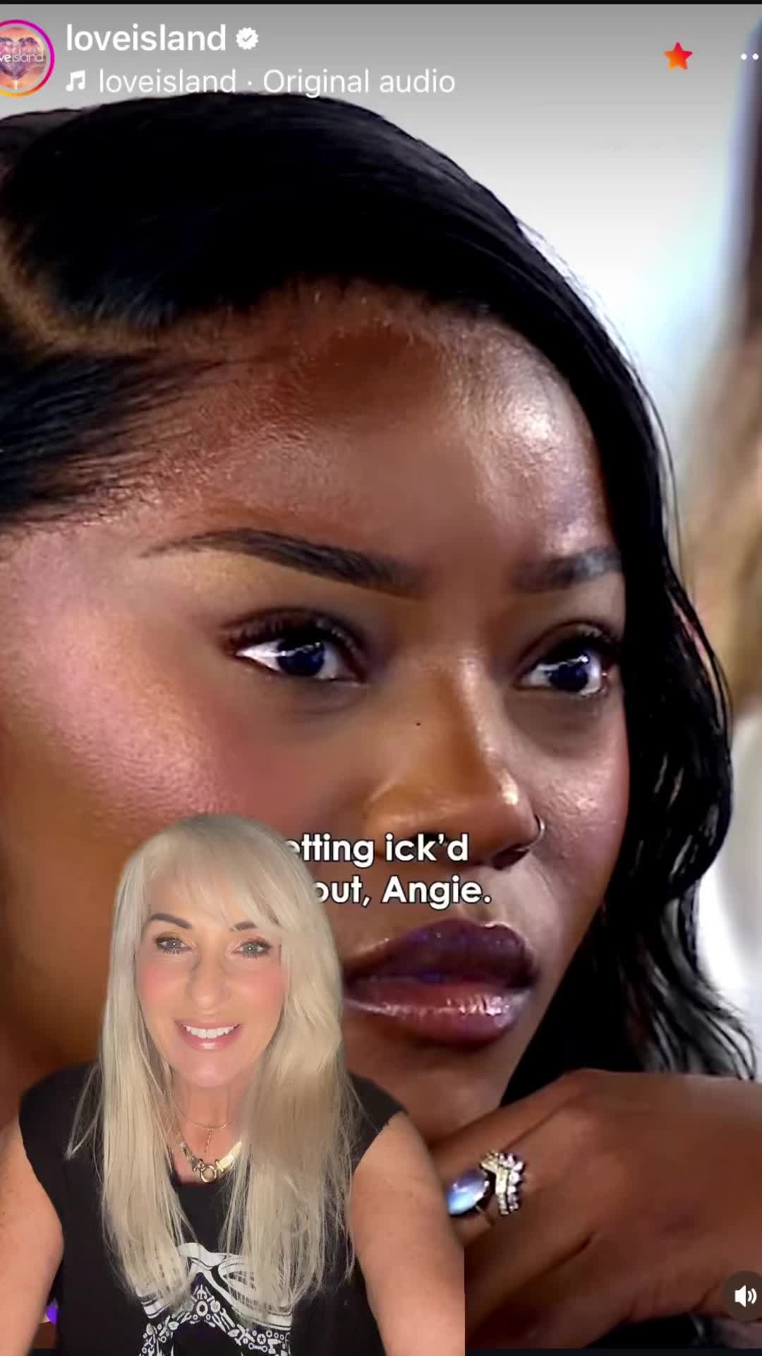 @lipglossles