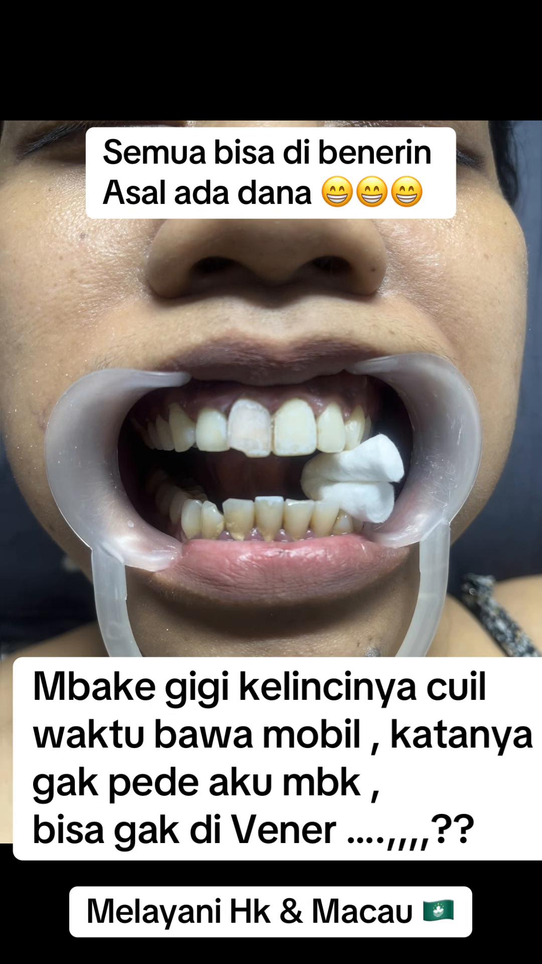 @mbak-Paijem