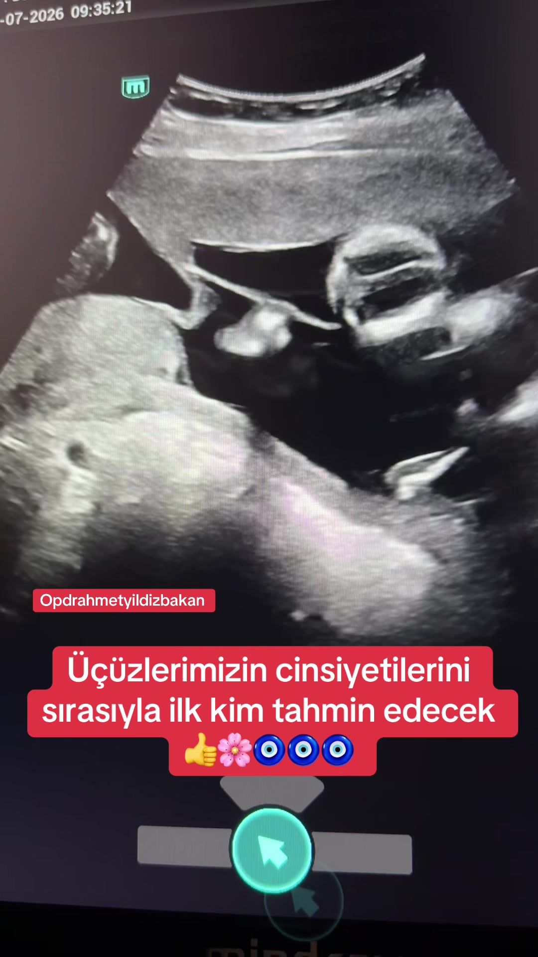 @opdrahmetyildizbakan
