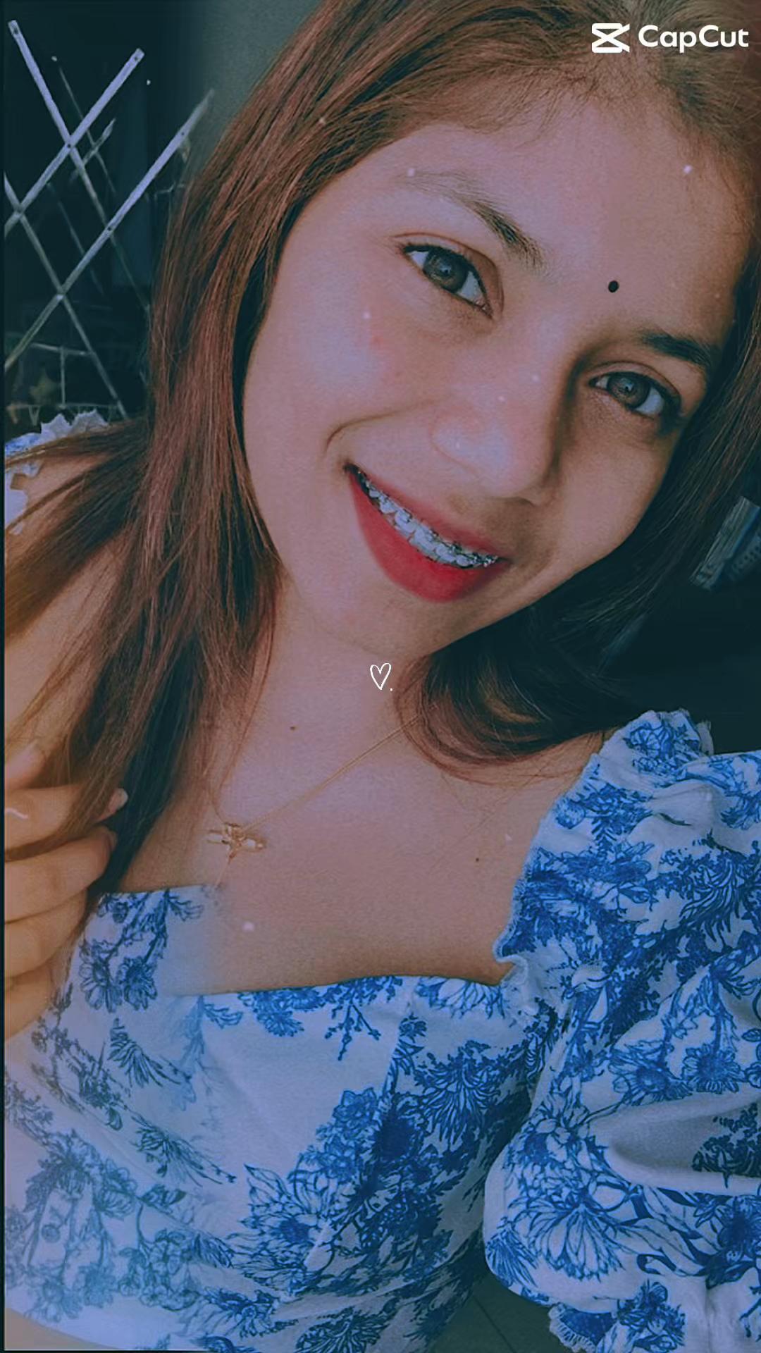 @G|20🦋