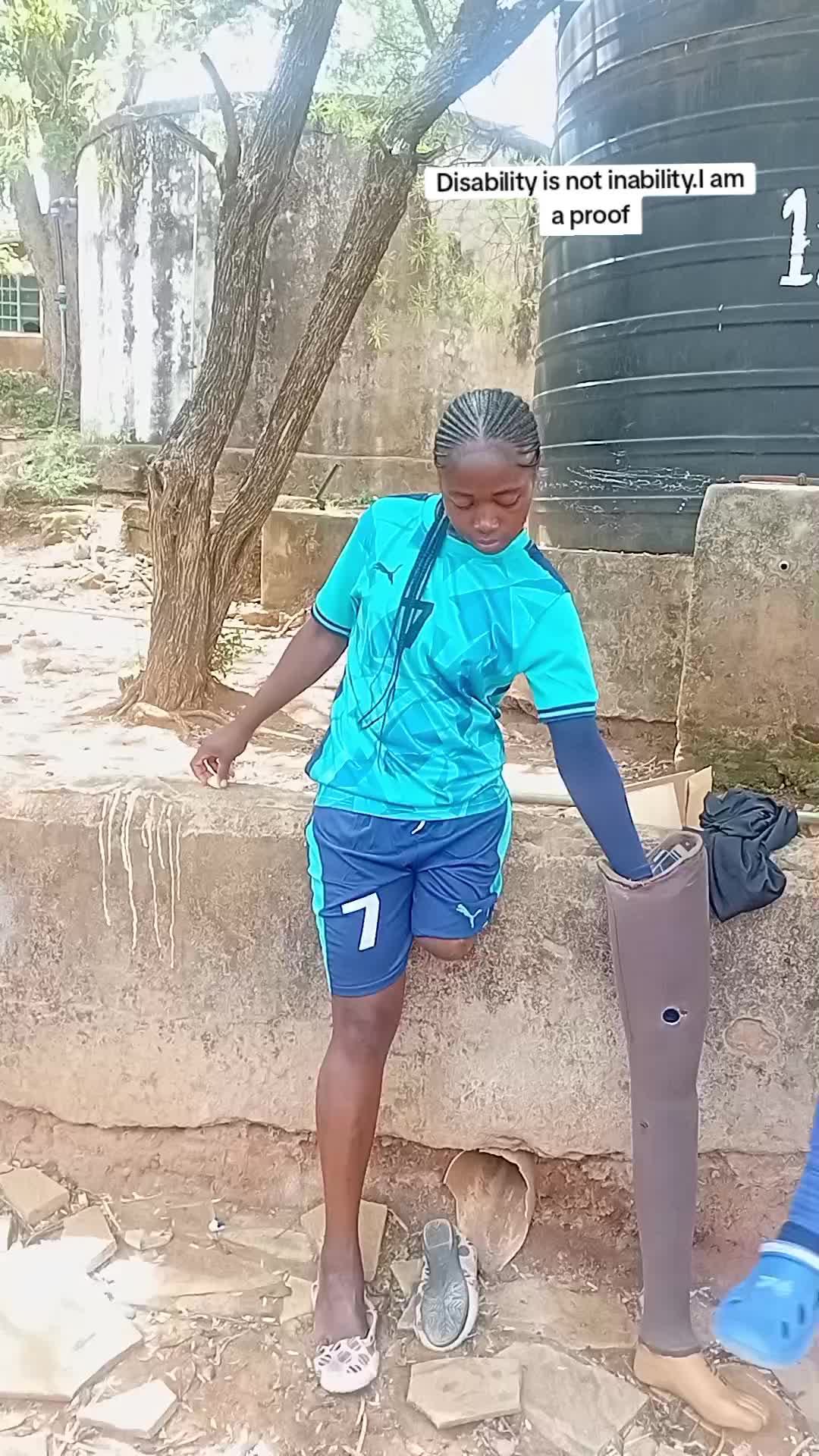 @Amputee girl