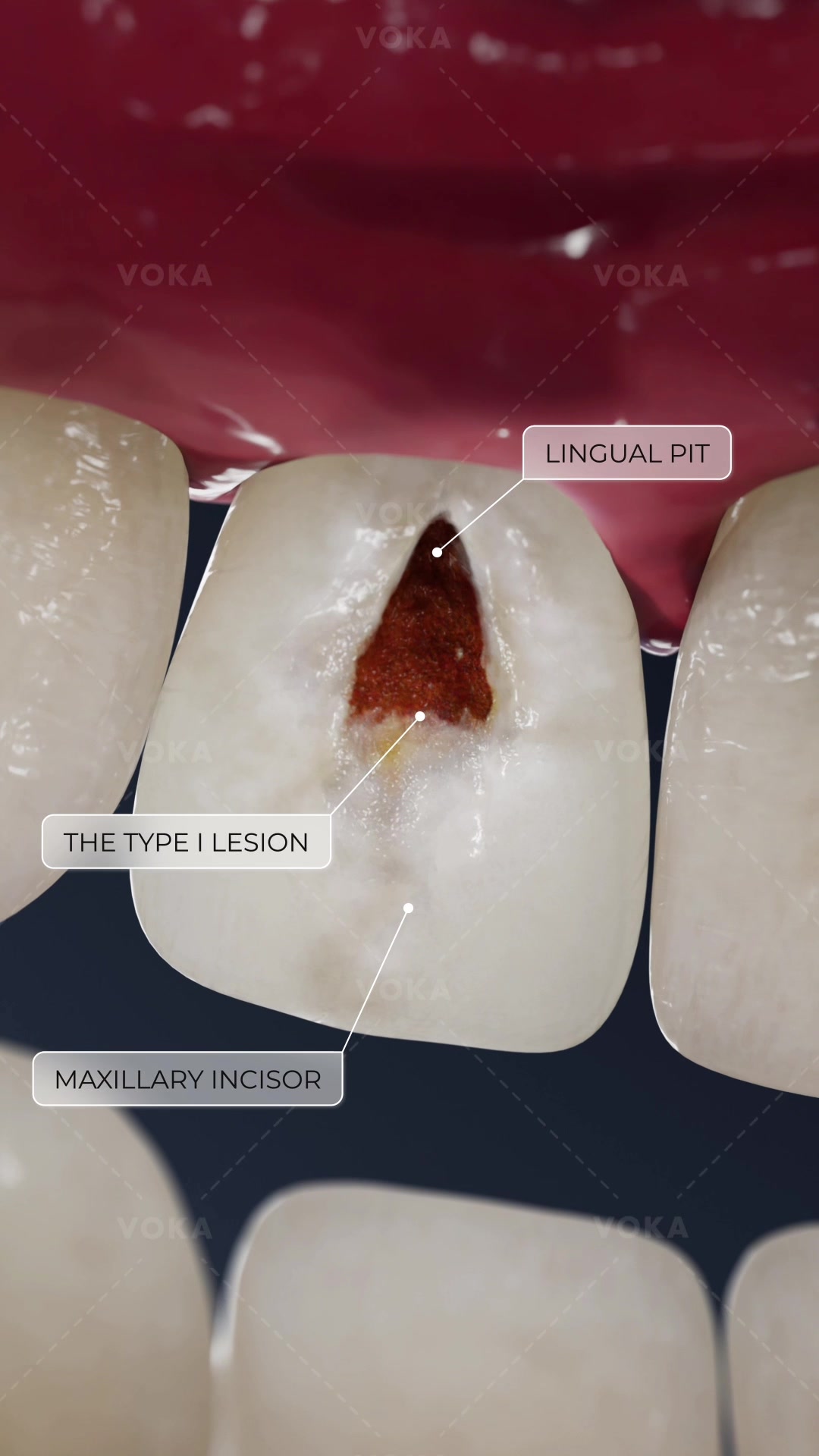 @VOKA 3D Anatomy & Pathology
