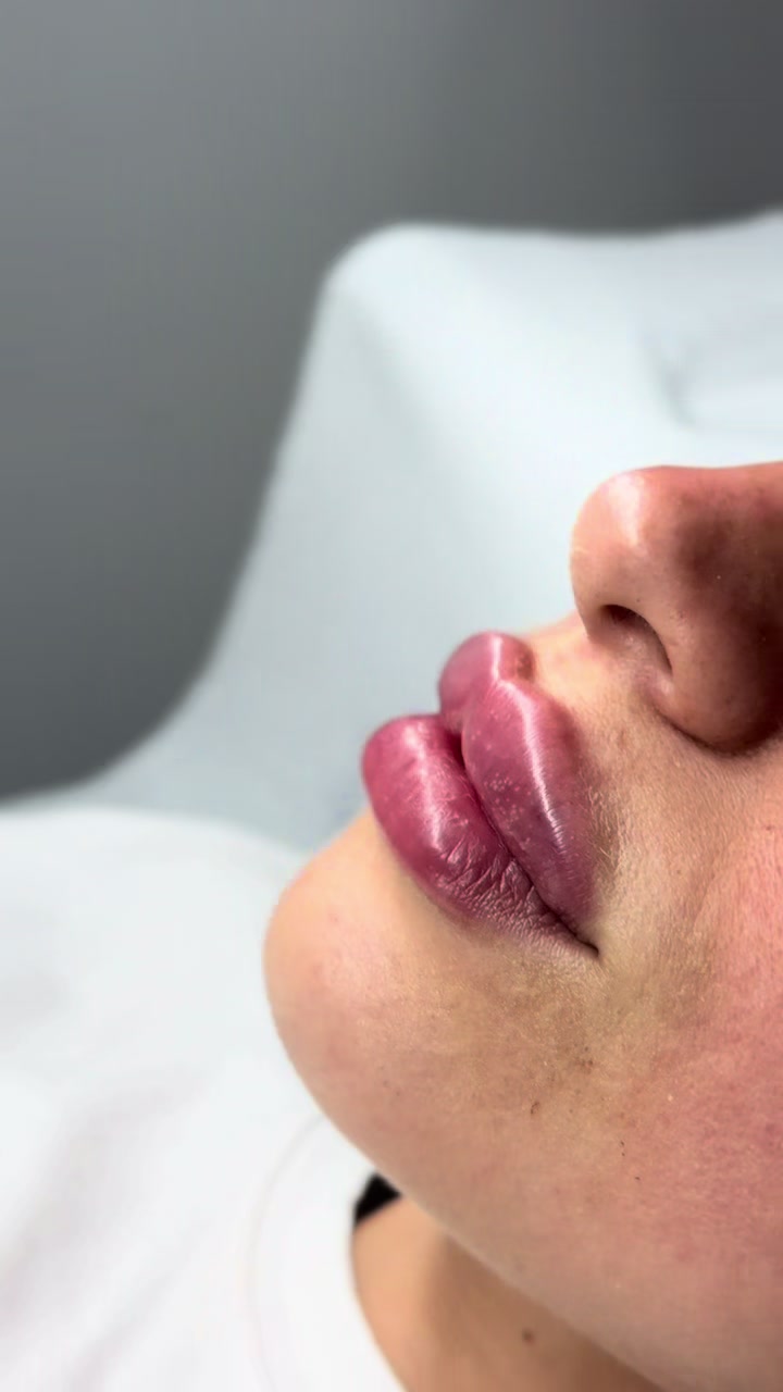 @Rosa.medical.cosmetic💉💕